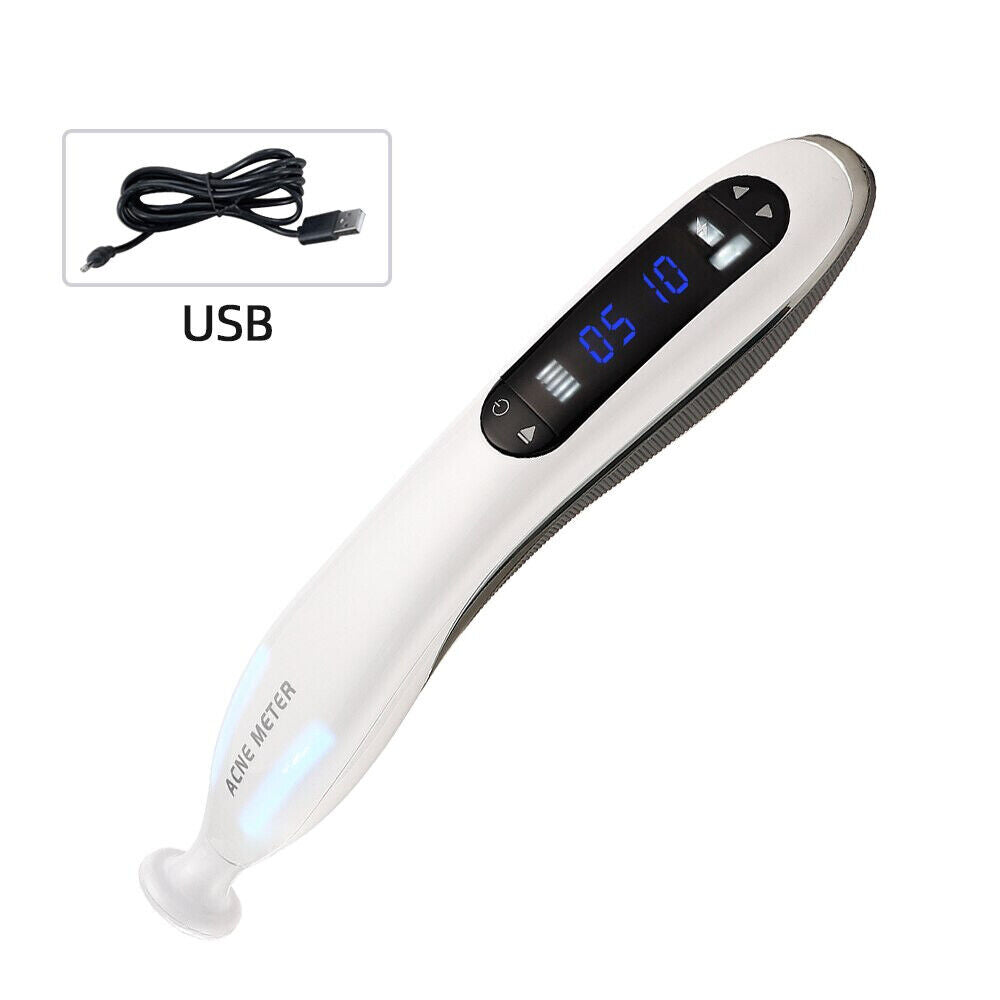 Ozone Plasma Pen Acne Scar Removal XYZDreams