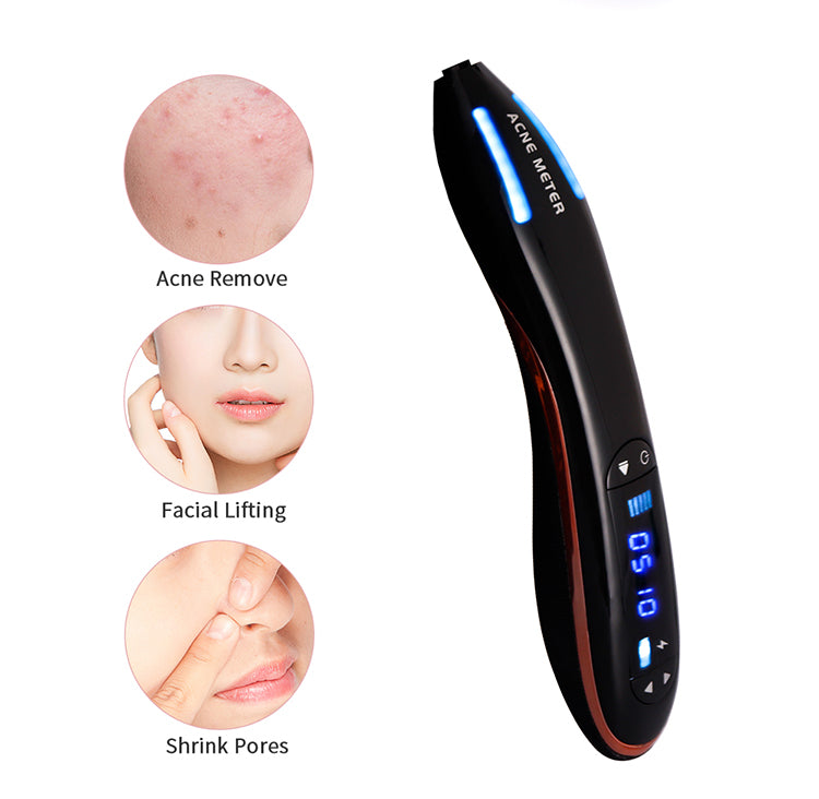 Ozone Plasma Pen Acne Scar Removal XYZDreams