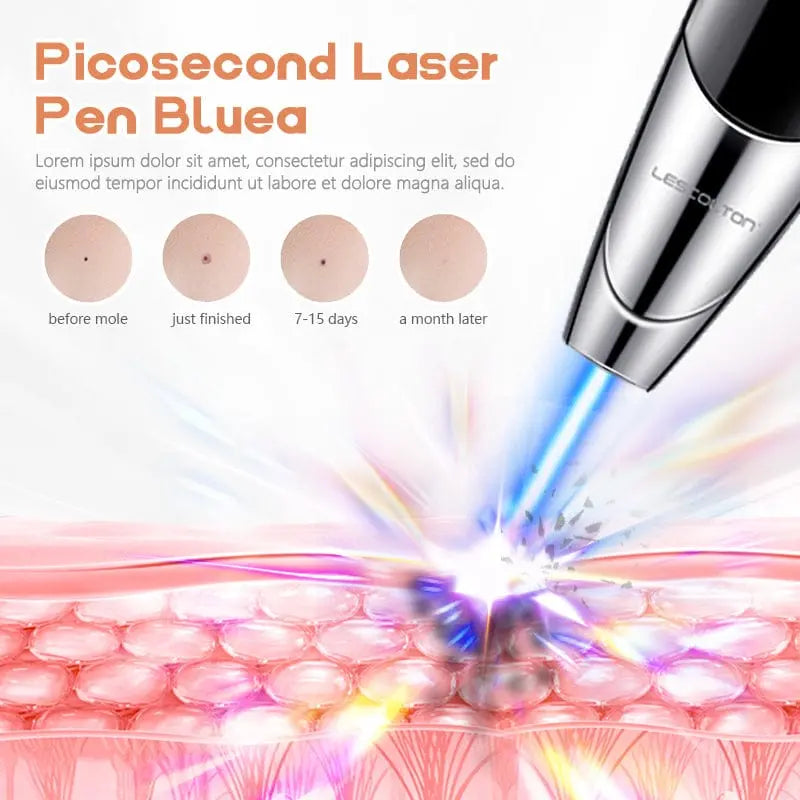 Tattoo Laser Scar Spot Removal Pen Mole Remove Picosecond Blue Light Therapy XYZDreams