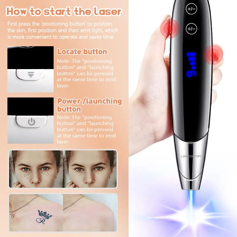 Tattoo Laser Scar Spot Removal Pen Mole Remove Picosecond Blue Light Therapy XYZDreams